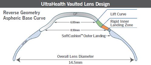 ultrahealth vaulted lens design great vision